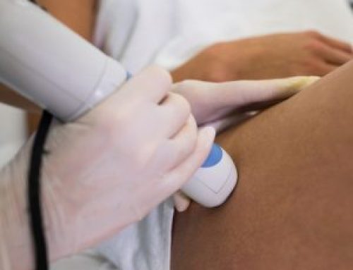 Descubra os Melhores Tratamentos para Frouxidão Vaginal